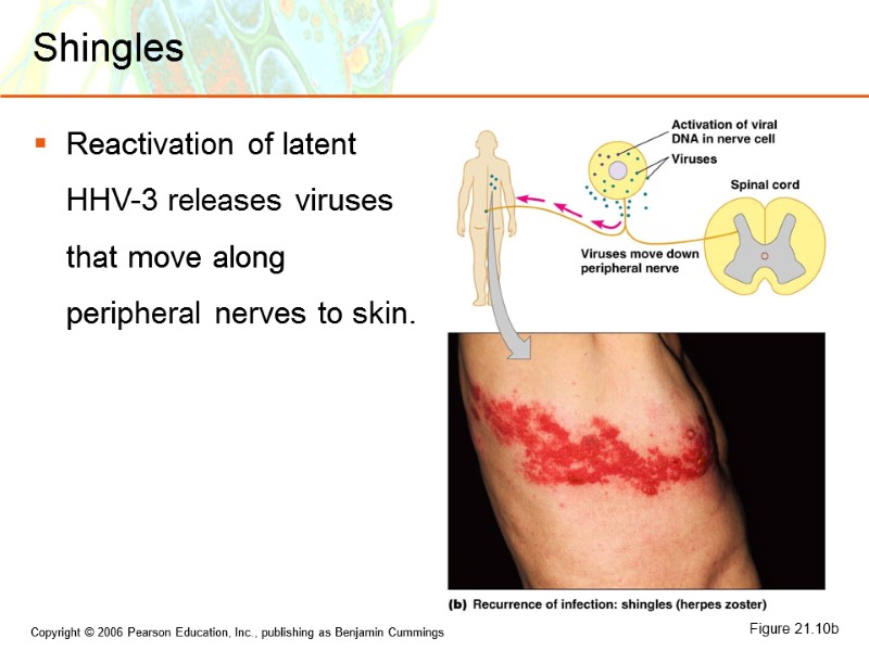 Shingles Reactivation of latent HHV-3 releases viruses that move along peripheral nerves to skin.